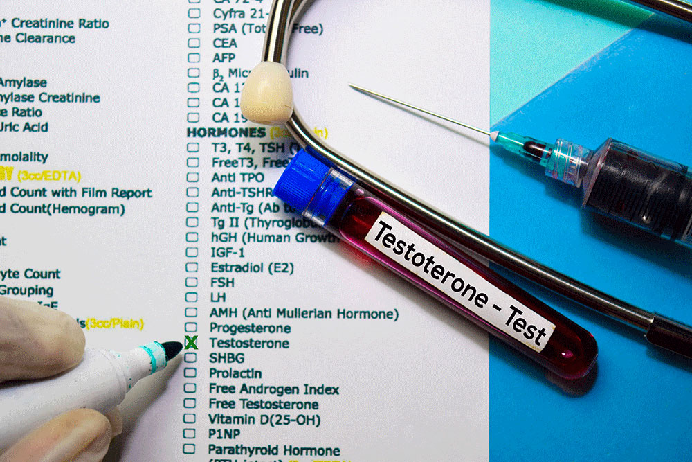 How to Buy Testosterone Injections testosterone test