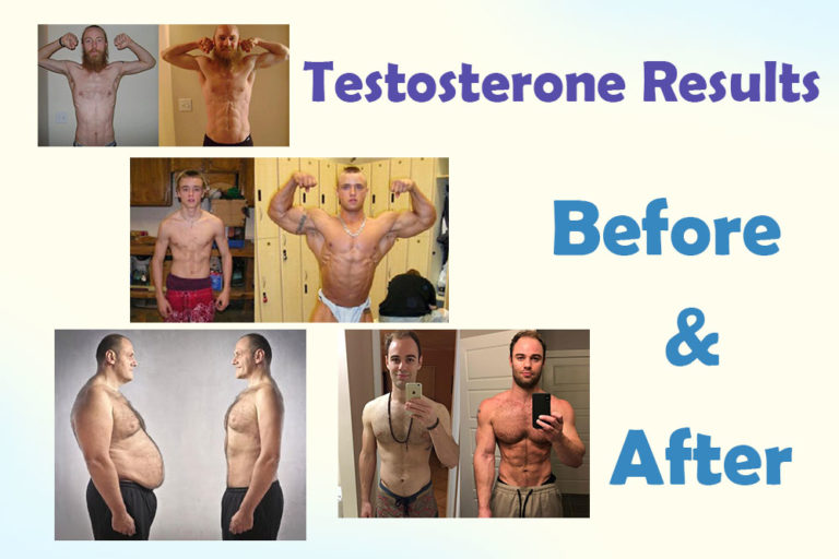 Treatment Of Low Testosterone Before And After Hrtus 7918
